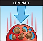 Eliminate - E in ICE